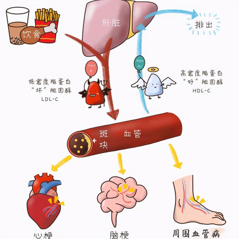 血脂四項(xiàng)的重要性.jpg